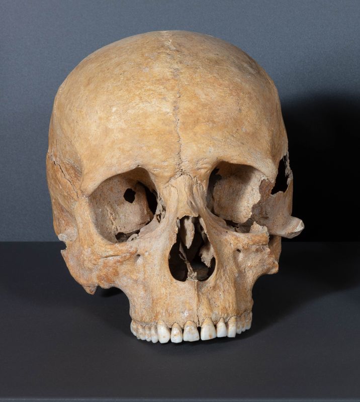 carni UF61 ind. 03 UE526 de Cal Pa i Figues [crani, restes humanes], segle XIV, Cal Pa i Figues